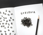 Revolutionizing Dyslexia Detection: Unveiling the Power of Multi-Source Data and AI Models