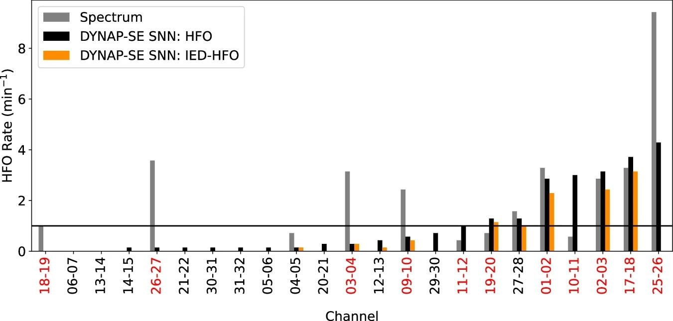 Comparison of DYNAP-SE SNN and Spectrum9 detectors in Patient 5. The rates obtained with the DYNAP-SE SNN for HFO (black) and IED-HFO (orange) were compared with the HFO rates of the Spectrum detector (gray bars). Most of the channels with high rates were the same for both detectors. In this patient, all the channels with high HFO and IED-HFO rates were recorded from tissue that was later resected (red labels). The patient achieved seizure freedom after surgery and was classified as a true negative (TN). This supports our hypothesis that the detected epileptiform patterns indicate the epileptogenic zone. HFO high-frequency oscillation, IED interictal epileptiform discharge. https://www.nature.com/articles/s41467-024-47495-y